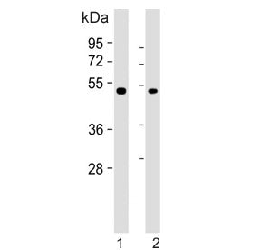Western blot testing of human 1) A549 and 2) SK-BR-3 cell lysate with Inhibin beta B chain antibody.