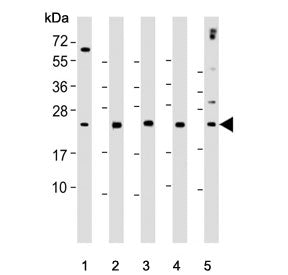 Western blot testing of human 1) WiDr, 2) Raji, 3) K562, 4) Jurkat and 5) CCRF-CEM cell lysate with CTLA4 antibody. Predicted molecular weight ~25 kDa but may be observed at higher molecular weights due to glycosylation.