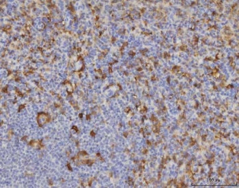Malic enzyme 1 Antibody / ME1