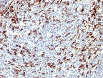 IHC testing of FFPE human tonsil with PD1 antibody. Required HIER: steam sections in 10mM Tris with 