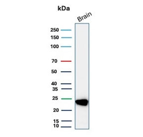 Western blot testing of human brain tissue lysate with PGP9.5 antibody. Predicted molecular weight ~