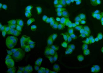 Immunofluorescent staining of FFPE human T-47D cells with Vesicle-fusing ATPase antibody (green) and