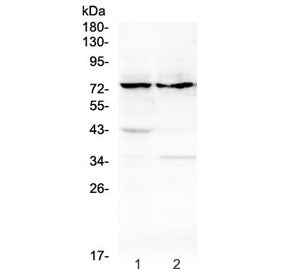 Western blot testing of rat 1) thymus and 2) stomach tissue lysate with ADAM10 antibody at 0.5ug/ml.