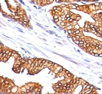 Ornithine Decarboxylase Antibody / ODC1