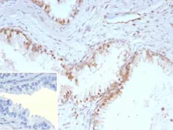 IHC staining of FFPE human prostate tissue. Strong nuclear staining observed using recombinant p27 a