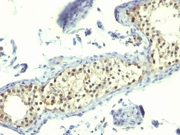 Thymidylate Synthase Antibody