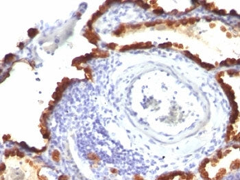 KRT7 Antibody Cocktail / Cytokeratin 7