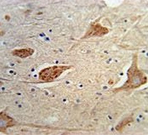 IHC testing of FFPE human brain tissue with FGFBP3 antibody. HIER: steam section in pH6 citrate buff