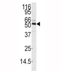 Western blot analysis of CAMKK1 antibody and mouse thymus tissue lysate. Predicted molecular weight 