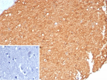 IHC staining of FFPE human brain tissue with recombinant Brain Creatine Kinase antibody (clone CKBB/