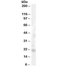 FGF21 Antibody