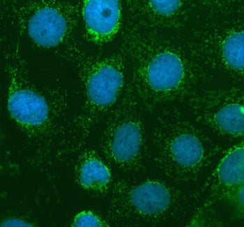 Immunofluorescent staining of ABCG5 using anti-ABCG5 antibody (green). ABCG5 was detected in an immu