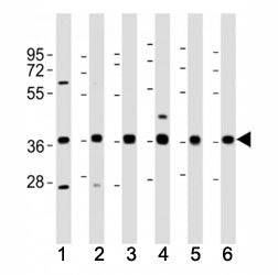 MICA Antibody