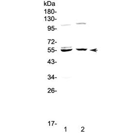 Western blot testing of human 1) HeLa and 2) SGC-7901 cell lysate with Caspase 8 antibody at 0.5ug/m