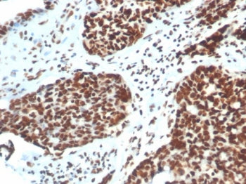 IHC staining of FFPE human colon tissue with XRCC5 / Ku86 / Ku80 antibody (clone XRCC5/7316). HIER: 