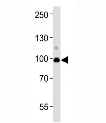 Western blot analysis of lysate from human kidney tissue lysate using ACE2 antibody diluted at 1:100
