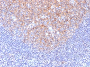 IHC testing of FFPE human tonsil with CD81 antibody (clone 1.3.3.22). Required HIER: boil tissue sec