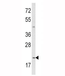 IL-12 Antibody