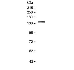 Western blot testing of human Caco-2 lysate with LRIG1 antibody at 0.5ug/ml. Expected molecular weig
