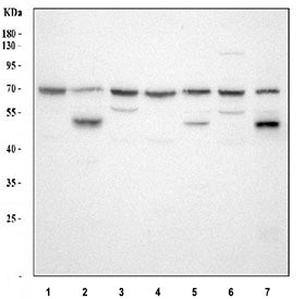 Western blot testing of HGF antibody and mouse NIH3T3 cell lysate. Predicted molecular weight: 76-91