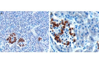 IHC testing of FFPE human pancreas with CCKAR antibody at 10ug/ml. HIER: microwaved with pH6 citrate
