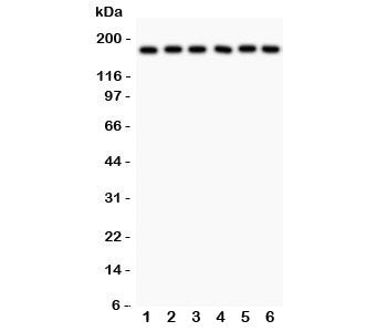 Western blot testing of PAPP-A antibody and human samples 1: placenta; 2: HT1080; 3: SKOV; 4: 22RV1;