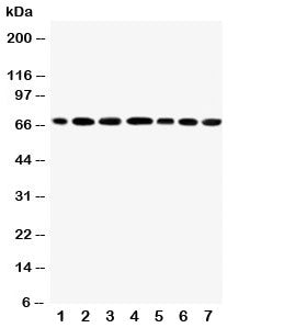 Western blot testing of DDX5 antibody and Lane 1: rat testis; 2: mouse testis; 3: human HeLa; 4: (h)