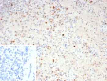 Resistin Antibody / RETN