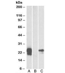Western blot test of HEK293 lysate overexpressing human WFDC2-MYC with WFDC2 antibody [1ug/ml] in La
