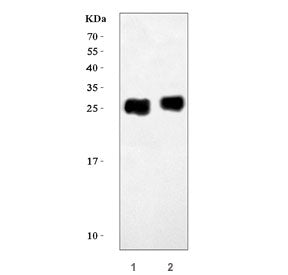 Troponin I Antibody / TNNI3
