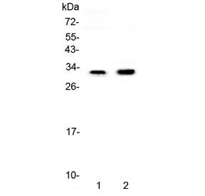 Western blot testing of 1) rat kidney and 2) mouse kidney lysate with Connexin 32 antibody at 0.5ug/
