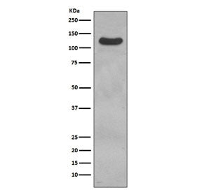 Western blot testing of human ThP-1 cell lysate with CD31 antibody. Expected molecular weight: 83-13