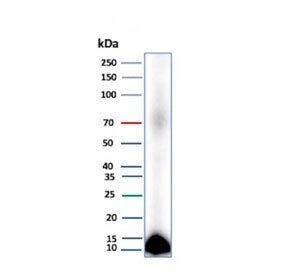 Western blot testing of human pancreas tissue lysate with Colipase antibody (clone CLPS/9026). Predi