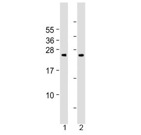 Western blot testing of human 1) cerebellum and 2) spleen tissue lysate with Grancalcin antibody at 