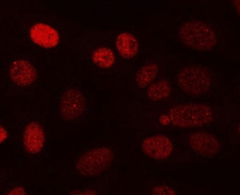 Immunofluorescent staining of FFPE human U-2 OS cells with PPP3CA antibody (red). HIER: steam sectio