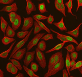 Immunofluorescent staining of FFPE human A549 cells with RB1 antibody (green) and Beta Tubulin mAb (