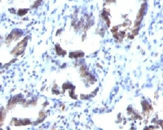 SM22 alpha Antibody / Transgelin