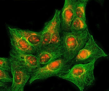 Immunofluorescent staining of FFPE human U-2 OS cells with RASSF2 antibody (red) and Alpha Tubulin m
