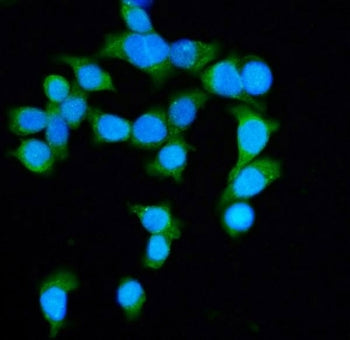 Immunofluorescent staining of FFPE human Caco-2 cells with Diaphanous Homolog 1 antibody (green) and