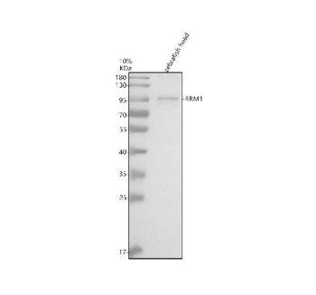 Western blot analysis of Rrm1 protein using Rrm1 antibody and zebrafish head tissue lysate. The pred