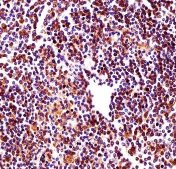 IHC testing of FFPE human spleen tissue with RBM22 antibody. HIER: steam section in pH6 citrate buff