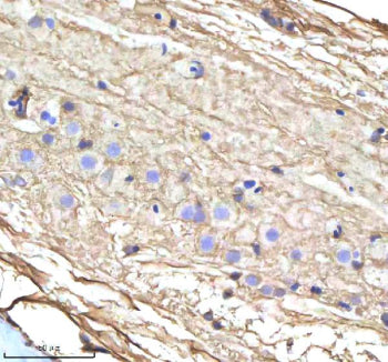 IHC staining of zebrafish Cyp17a1 protein using Zebrafish Cyp17a1 antibody, HRP-labeled secondary an
