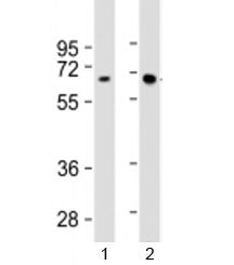 Western blot testing of human 1) Jurkat and 2) MCF-7 cell lysate with HEXB antibody at 1:2000. Predi