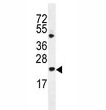 Bax antibody western blot analysis in HL-60 lysate