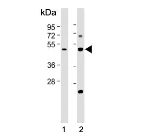 GAL3ST1 Antibody / Galactosylceramide sulfotransferase