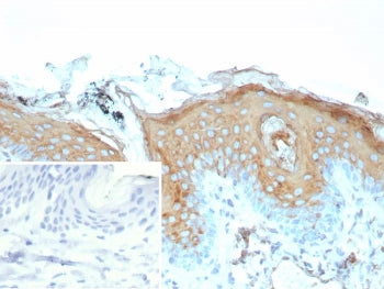 IHC staining of FFPE human skin tissue with recombinant IVL antibody (clone rIVRN/9323). Inset: PBS 