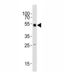 Smad1 Antibody