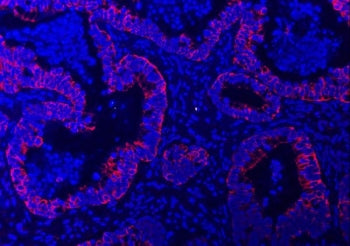 TRAM1L1 Antibody / Translocating chain-associated membrane protein 1-like 1