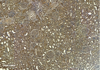 IHC staining of FFPE human kidney tissue with FCER1A antibody at 6ug/ml. Required HIER: steamed anti