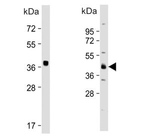 Western bot testing of two different lots of human K562 cell lysate with OTU1 antibody. Predicted mo